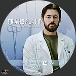 Filename=Transplant_S4D3.jpg
Filesize=703KiB
Dimensions=1500x1500
Date added=Oct 08, 2025 Transplant_S4D3.jpg