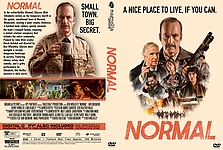 Normal.jpg